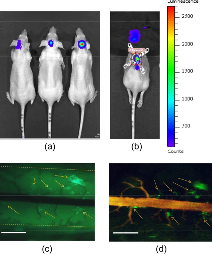 Figure 7. Intravital multispectral fluorescence microscopic imaging of medulloblastoma tumor metastasis to the spinal cord