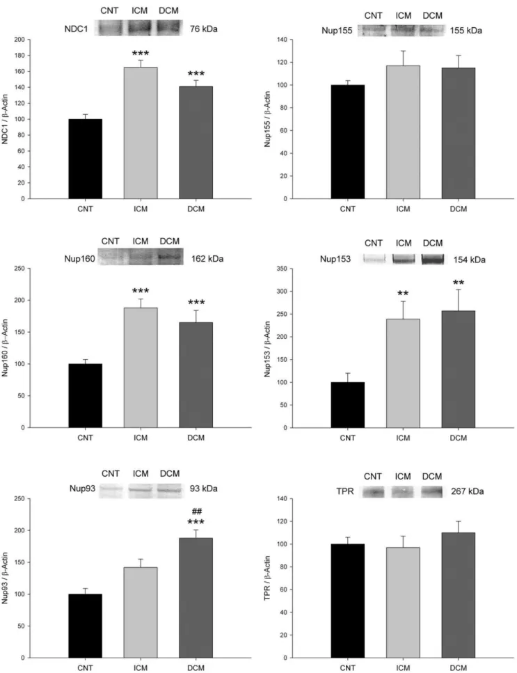 Figure 1. Influence of heart failure aetiology on the levels of nucleoporins. NDC1, Nup155, Nup160, Nup153, Nup93 and TPR were analysed by Western blot techniques