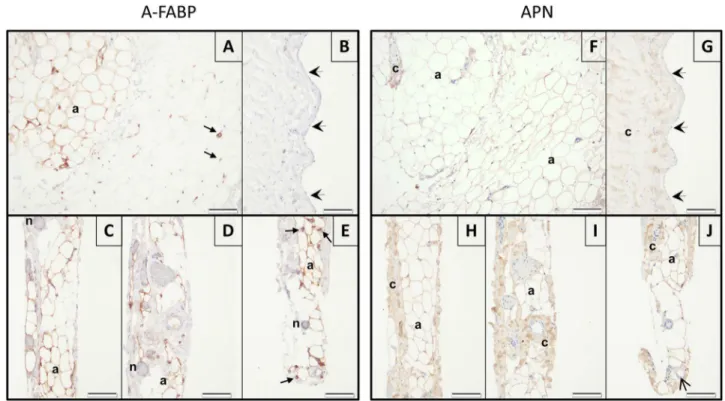 Fig 3. Representative images of immunohistochemical stainings of adipocyte fatty acid-binding protein (A-FABP; left) and adiponectin (APN; right) in the parietal pericardium