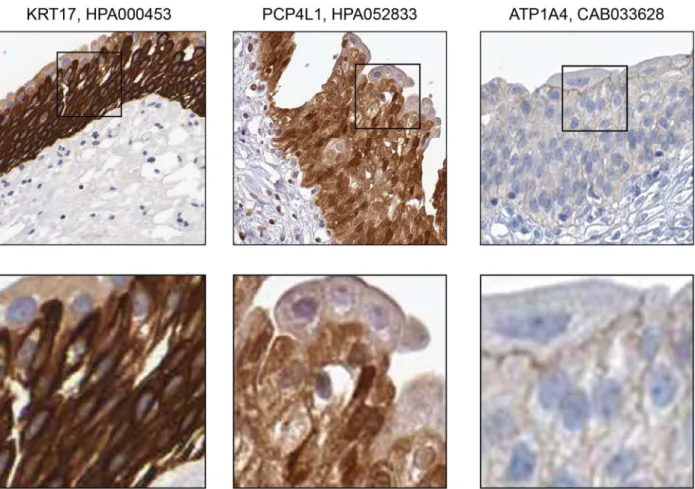 Fig 4. Immunohistochemistry-based protein profiling of elevated genes in urinary bladder that are expressed in intermediate/basal layer cells