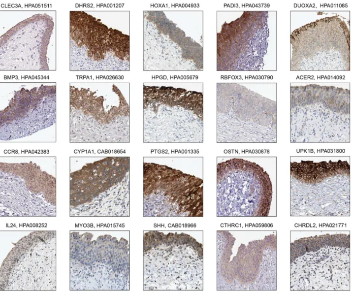 Fig 2. Immunohistochemistry-based protein profiling of elevated genes in urinary bladder that are expressed in urothelium