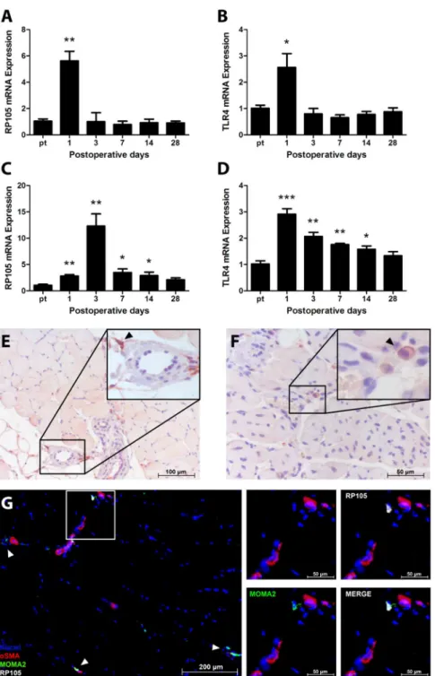 Figure 1. RP105 and TLR4 in arteriogenesis in WT mice. RP105 mRNA (A) and TLR4 mRNA (B) expression in the adductor muscle group after induction of HLI, measured by real-time quantitative PCR