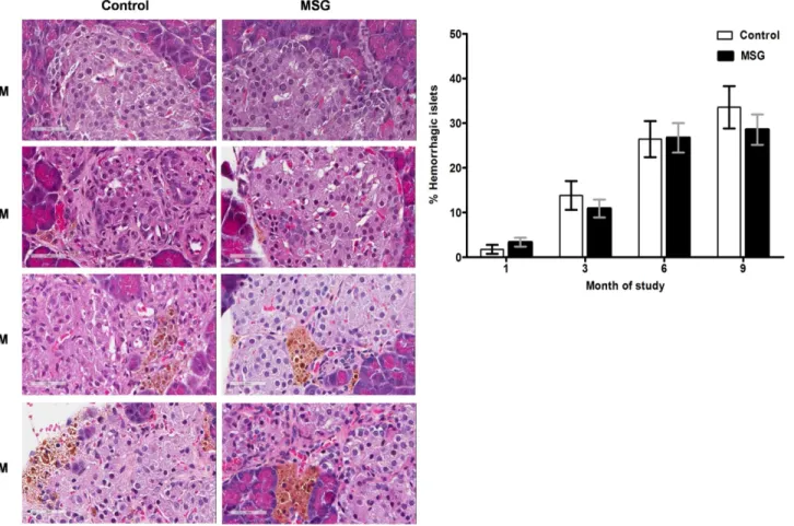 Fig 2. Representative histology (left) and prevalence (right) of islets hemorrhage/hemosiderin deposits in the control and MSG-treated group at 1, 3, 6, and 9 months (x400).