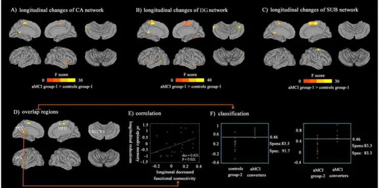 Figure 3. Longitudinal changes of hippocampus subregional networks. (A–C): Greater decreases in aMCI group-1 compared with controls group-1 between baseline and follow up