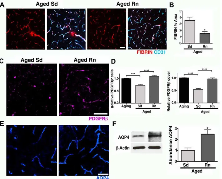 Fig 6. Exercise preserves neurovascular unit integrity in aged mice. (A–B) Age-related intravascular and extravascular deposition of FIBRIN (red) is significantly reduced in aged runner mice
