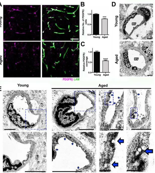 Fig 2. Pericyte loss and increased endothelial transcytosis in the aged cortex. (A) Reduction of PDGFRβ + pericytes (magenta) and laminin capillary coverage (green) is evident in the aged cortex when compared with the young cortex