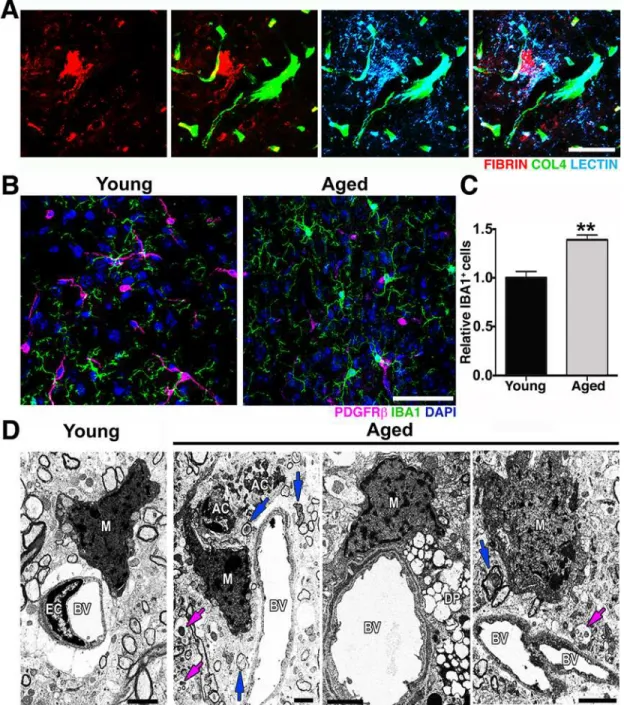 Fig 3. Microglia/monocyte density is increased in regions with pericyte loss in the aged cortex