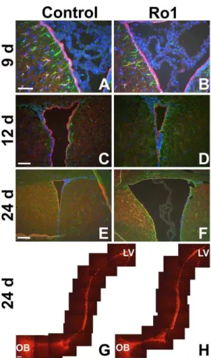 Figure 4. Lack of cellular changes in subventricular zone organization in early hydrocephalus in Ro1 mice