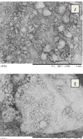 Figura 4 - MEV de amostras de HAp secas a 105°C  por  24  horas.  (a)  aumento  de  100X  (b)  aumento  de  1000X 