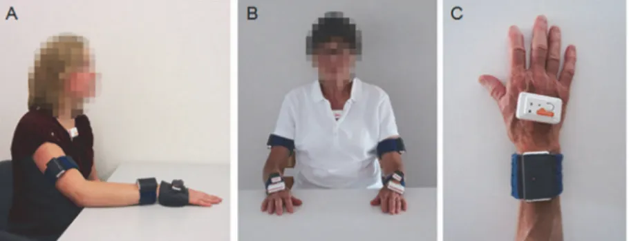 Fig 2. Placement of the sensor devices. A) placement on the dominant arm-hand and chest of healthy participants, B) bilateral placement on the arms, hands and chest of the stroke patient, C) top view of the placement of the sensor devices on the hand.