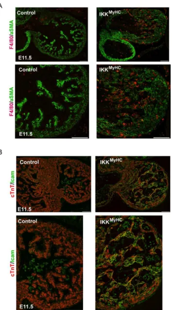 Fig 5. Cardiomyocyte-specific IKK/NF- κ B activation up-regulates cell-adhesion molecules and induces the recruitment of macrophages