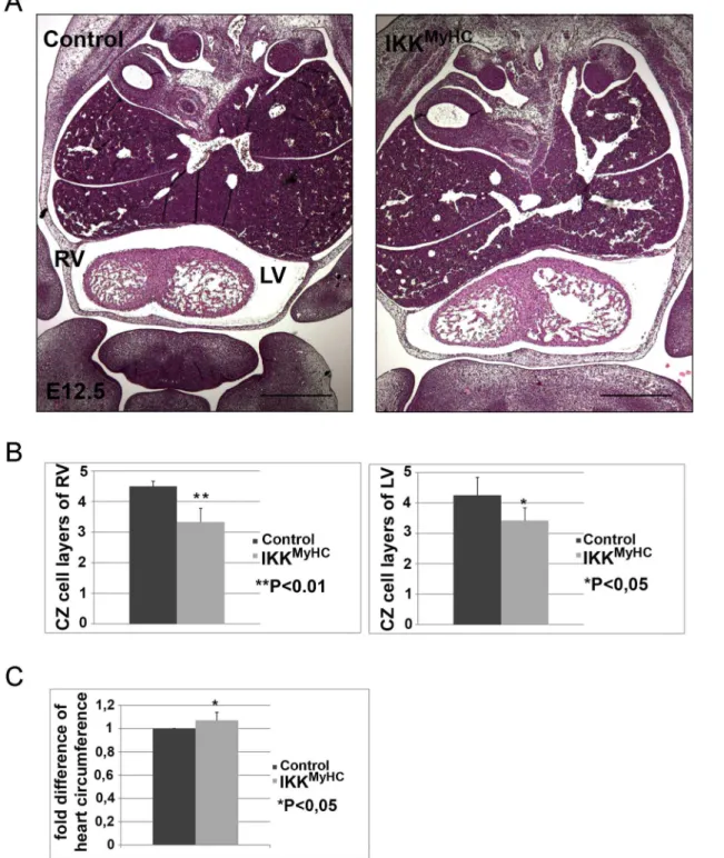 Fig 3. Cardiomyocyte-specific expression of IKK2-CA leads to defects in compact zone formation