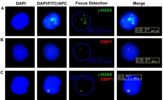 Fig 1. Examples of γ-H2AX and 53BP1 foci in PBMCs. (A) Multiple nuclear γ-H2AX foci (green) are clearly discernible in a lymphocyte of a healthy control