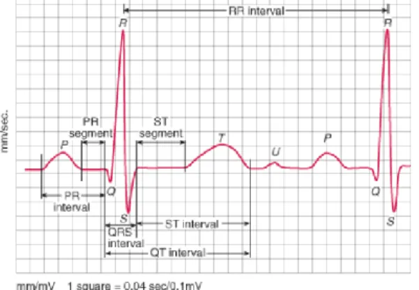 Figure 4- Image showing a normal ECG with QRS  complexes and R-R interval [123]