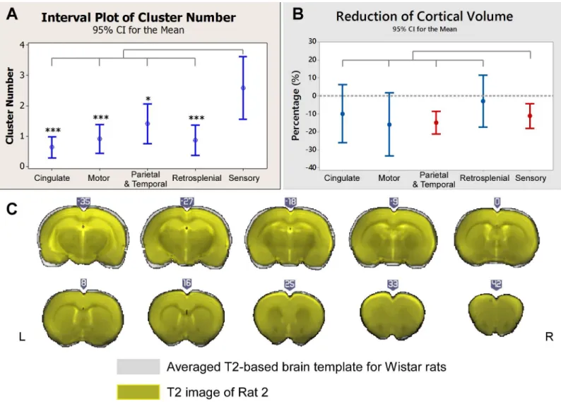 Fig 3. Distributions of irritative zones and morphological changes. (A) Comparisons of the numbers of IED-evoked BOLD response clusters for five cortical regions
