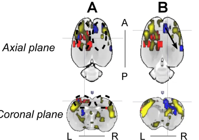 Fig 8. Representative relationship between the IED-evoked BOLD responses and RSN from Rat 2