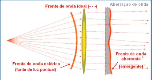 Figura 1.14. Representação gráfica dos conceitos de frente de onda e aberração de onda  (Adaptação de “Wavefront Customized Visual Correction”, The Quest for Super Vision  II, Ronald, R