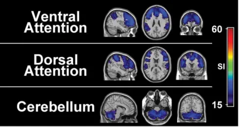 Figure 4. Module-specific SI images of modules with limited consistency. Three resting state networks (RSNs) exhibited attenuated consistency across subjects, relative to those shown in Figure 2