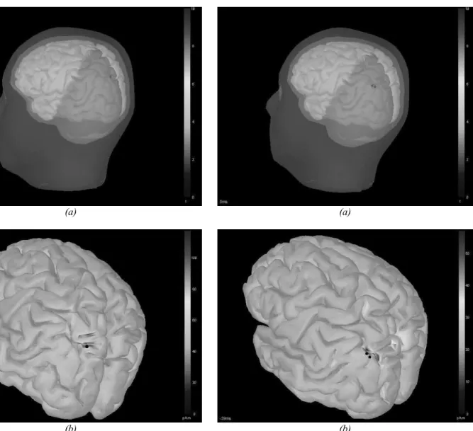Fig.  1.    Localization  Results  for  a  single  source  using  (a)  SAFFIRE,  MEG/EEG