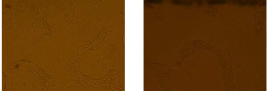 Fig. 1 Normal biopsy samples (left)   and OVX slice (right) under 4 magnification 