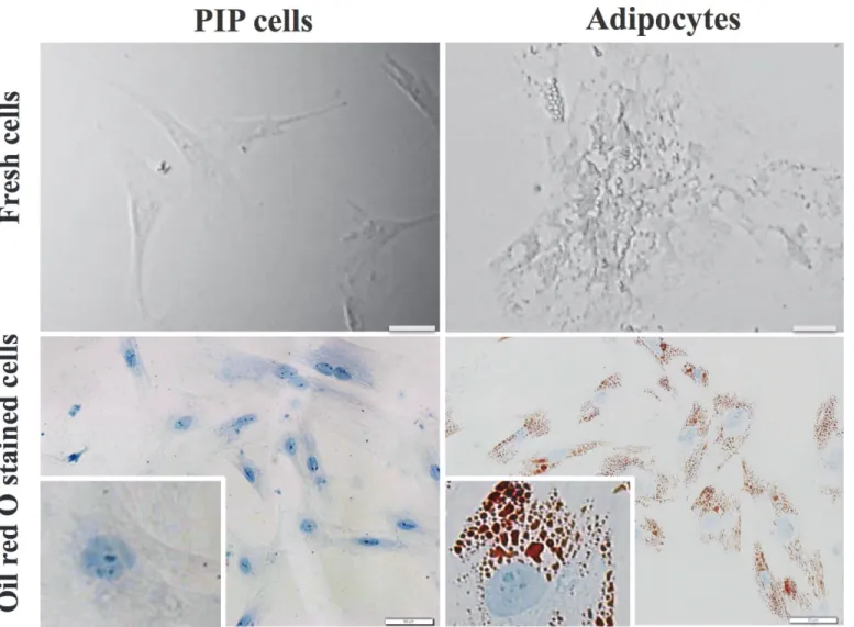 Fig 1. Photographic pictures of PIP and adipocyte cells. The PIP cells were grown at 37°C for 4 days, and subsequently fed with differentiation medium for another 4 days to differentiate into adipocyte cells