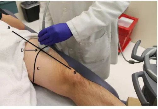 Figure 1 Participant positioning during ultrasound scanning procedure. The scanning site on the ante- ante-rior surface of the thigh (dominant side) was located by obtaining a measurement in cm from the anteante-rior superior iliac spine (A) and the superi