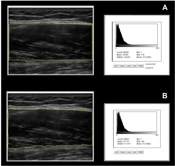 Figure 2 Image analysis ROI selections and the corresponding grayscale histogram values