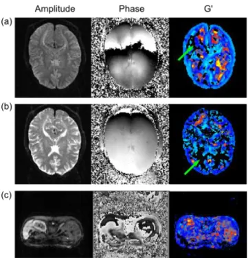 Figure 4.17. (a) Original amplitude and phase brain data at 25 Hz and its processed G‘ map