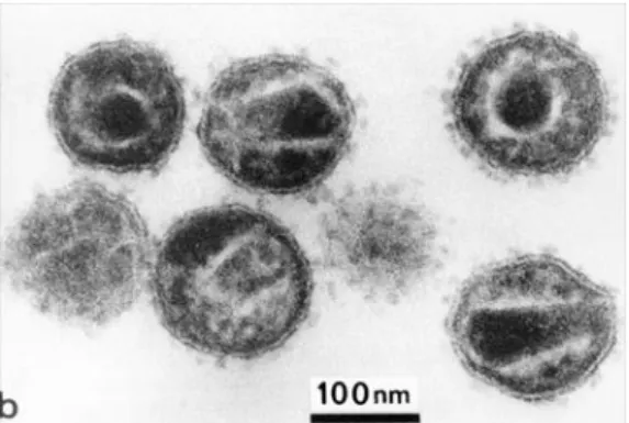 Figure  1.1  -  Electron  Micrograph  of  HIV.  The  virus  is  more  about  110  nm  wide