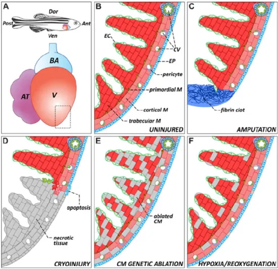 Figure 1.4 - Representative schematics about the zebrafish heart anatomy and injuries