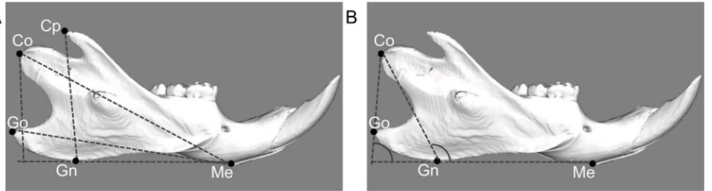 Fig 2. Landmarks and measurement items for linear analysis (A) and angular analysis (B) by 3D reconstructions