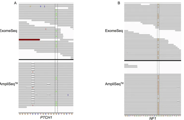 Fig 3. Read alignment view of PTCH1 (A) and NF1 (B) genes zoomed in to individual base level