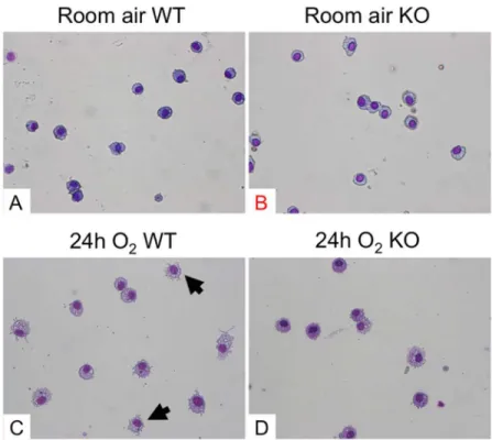 Fig 2. Hyperoxia-induced morphological alteration of alveolar macrophages is inhibited in ASK1 KO mice