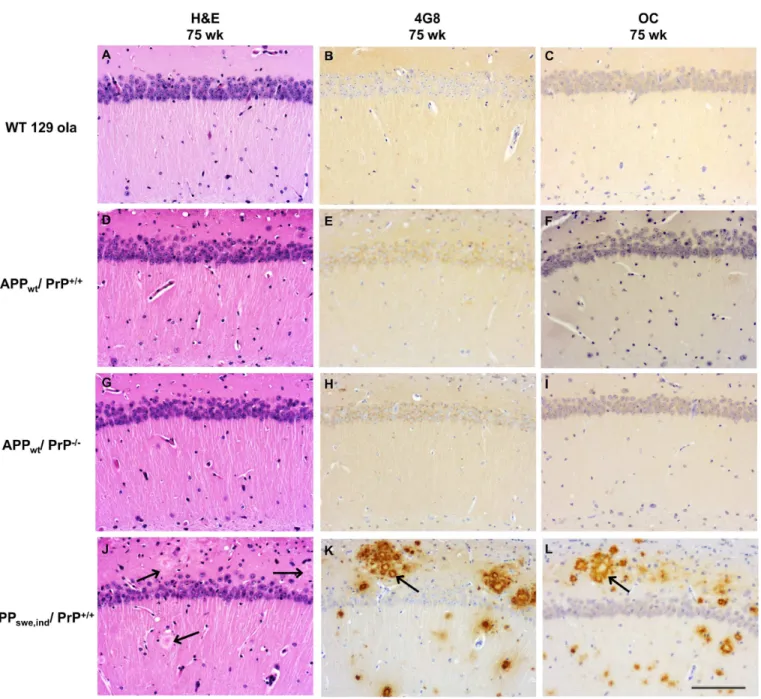 Fig 2. Ablation of PrP C does not affect Aβ deposition in APP WT mice. Histopathologic analysis of the hippocampus of hematoxylin-eosin stained sections of WT, APP WT /PrP ++ and APP WT /PrP – mice show absence of obvious alterations in the pyramidal cell 