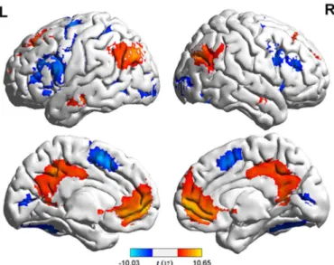 Fig 3. Results of comparisons between words and regular nonwords. Brain regions that demonstrated stronger activation to words are shown in warm color