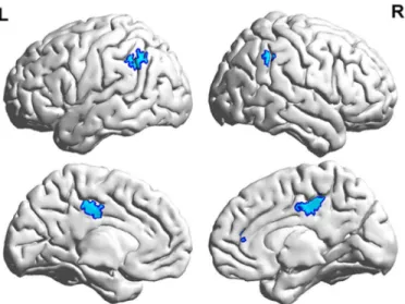 Fig 4. Conjunction results for the effects of transposable nonwords and lexicality (p < 0.001 uncorrected, k = 10).
