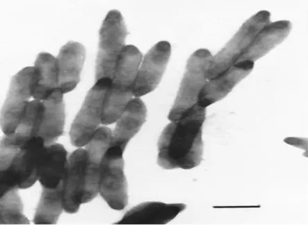 Figura 1- Microscopia eletrónica de células de T. whipplei extracelulares individuais.(Fonte: Scola et al 9 ) 