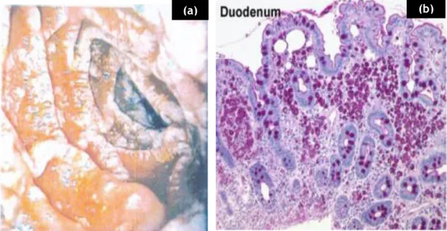 Figura  5-  EDA  (a)  e  biópsia  duodenal  (b).  (a)  Mucosa  duodenal  na  DW  clássica  vista  por  EDA