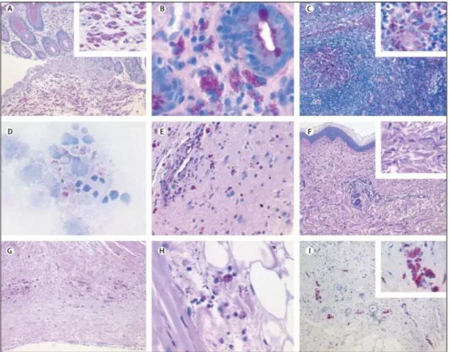 Figura 6- Deteção PAS de macrófagos em diferentes locais na DW. (A) Cólon. (B) Estômago