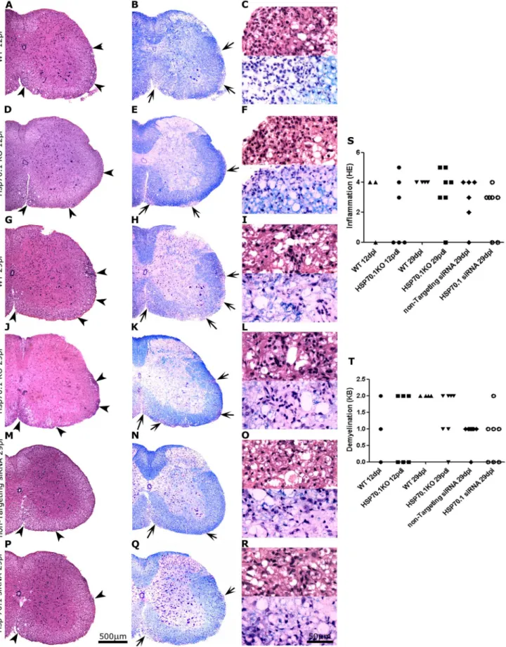 Figure 3. Histopathological study of the spinal cords of Hsp70.1 KO, WT and siRNA-treated mice