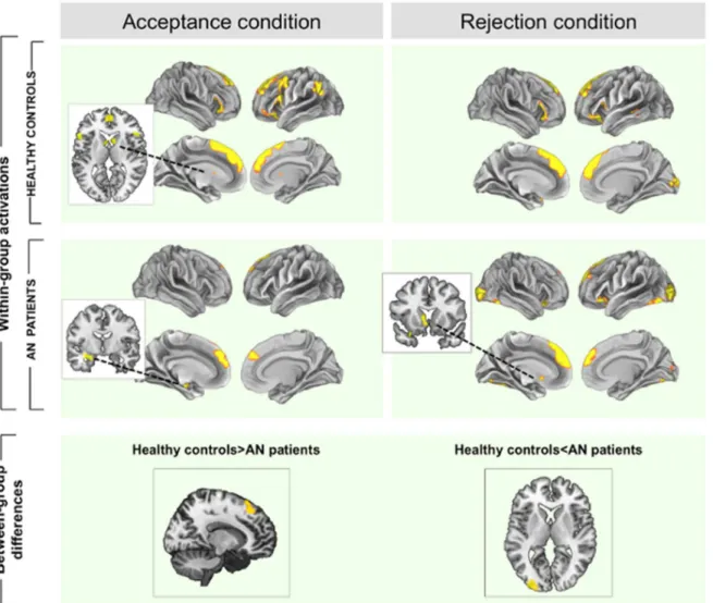 Fig 2. Within and between-group brain activations during acceptance and rejection feedback