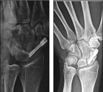 Fig. 5: Post-Operative X-Rays 