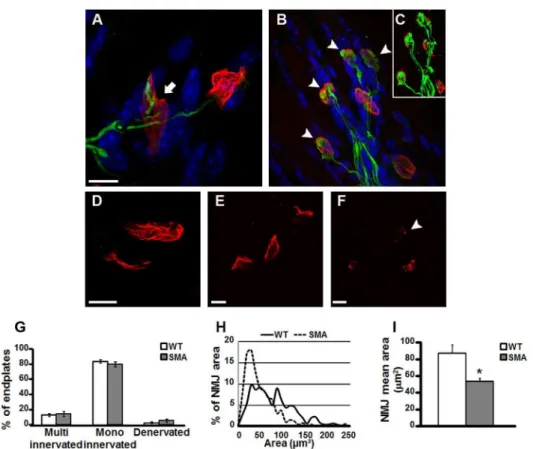 Fig 2. Architecture of the NMJ of the quadriceps in WT and SMA mice at P10. Panels A-B,