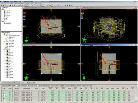 Figure 32 - Verification plan for ionization chamber, created with Varian Eclipse  software [25]