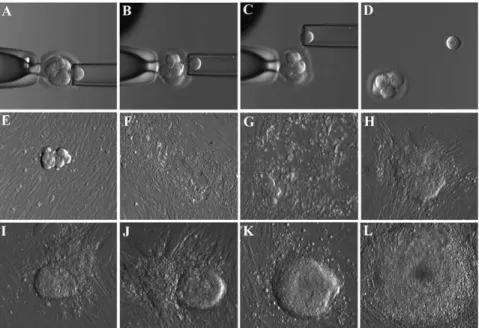 Figure 1. Derivation of hESC from biopsied blastomere of the cleavage stage embryo. Micrographs showing the stepwise procedure of embryo biopsy using inverted microscope-attached micromanipulator (A–D) and the appearance of initial outgrowth and hESC colon