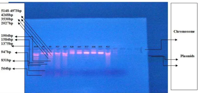 Figure  3:  plasmid  profile  of  E.  coli   strains  Lane  (A6,  A37,  A57,  A32):  Plasmid  DNA  extracted  from  E