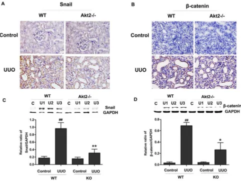 Figure 6. Effects of Akt2 deficiency on the phosphorylation of GSK3b after UUO. (A) Immunohistichemistry for p-GSK3b in unobstructed and obstructed kidneys from WT and Akt2 KO mice