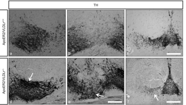 Figure 2. TH immunostaining of representative sections from mDA neurons of E18.5 mice