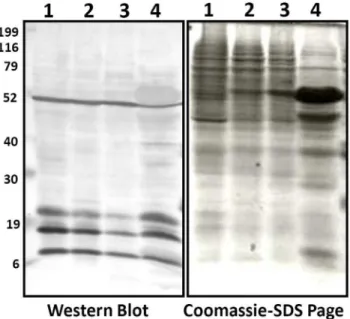 Figure 1. Lysine acetylation status is analyzed by using SDS- SDS-PAGE and Western blotting