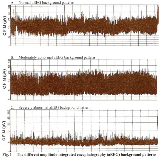 Fig. 1 –  The different amplitude-integrated encephalography (aEEG) background patterns